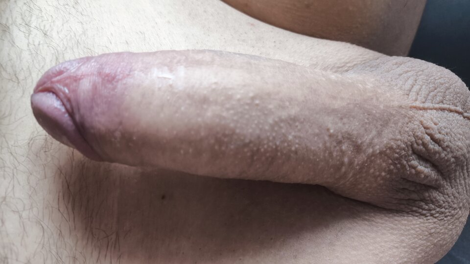 1000037732.jpg - tometom