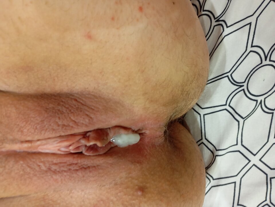 1000002709.jpg - Paragorlice