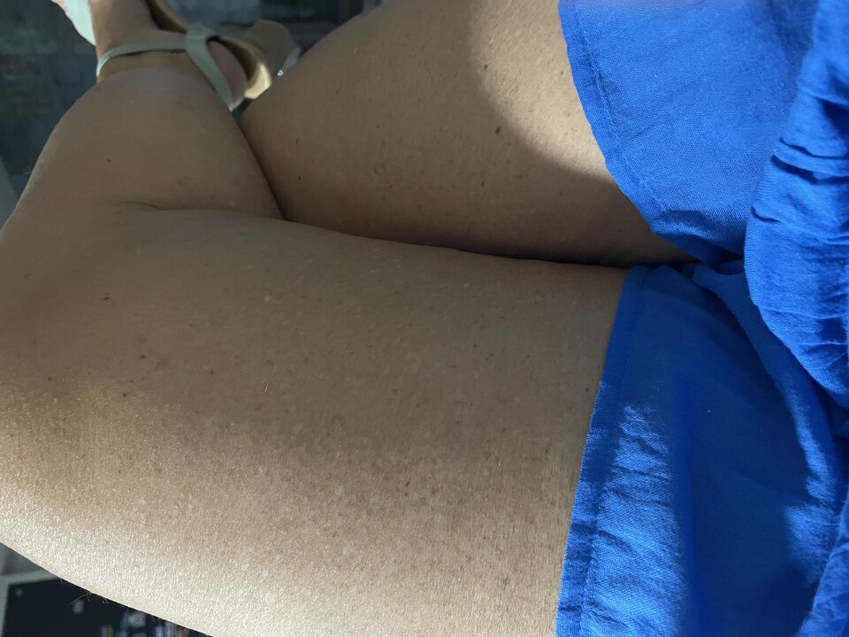 IMG_1968.jpeg - Solgirl