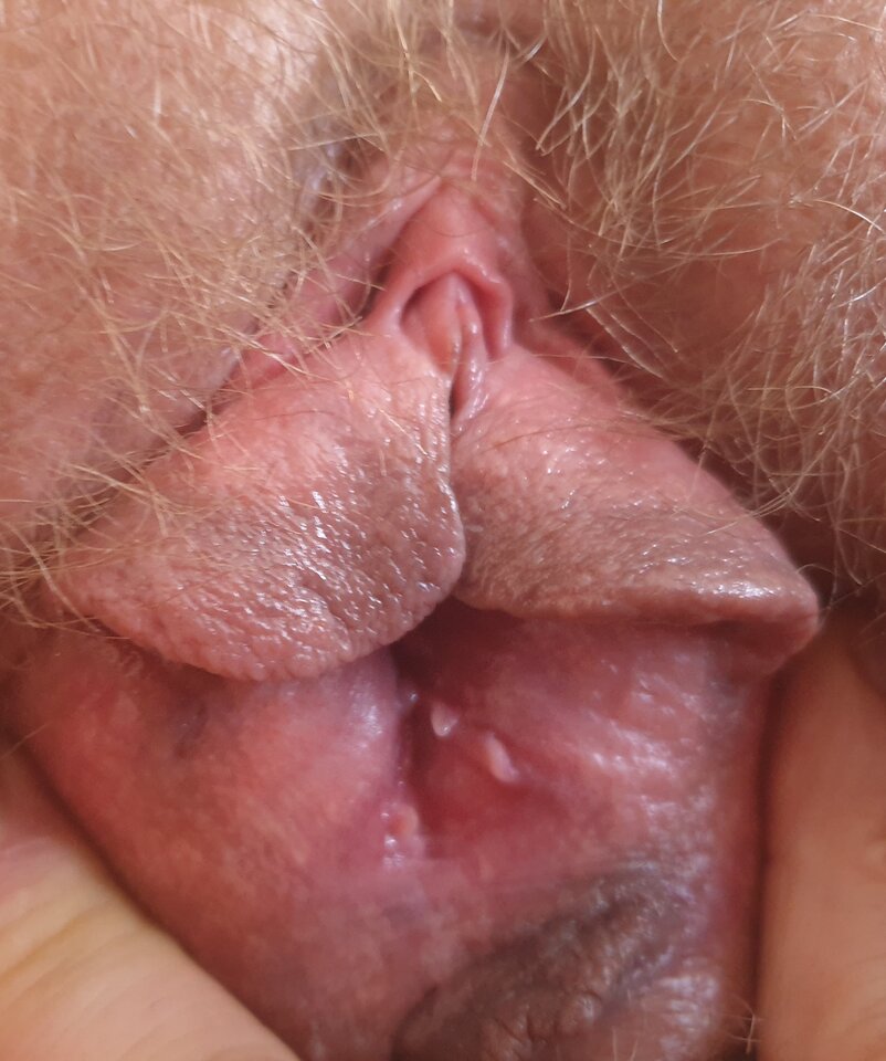 Rozchylona cipa do lizania  - Agibagi2022