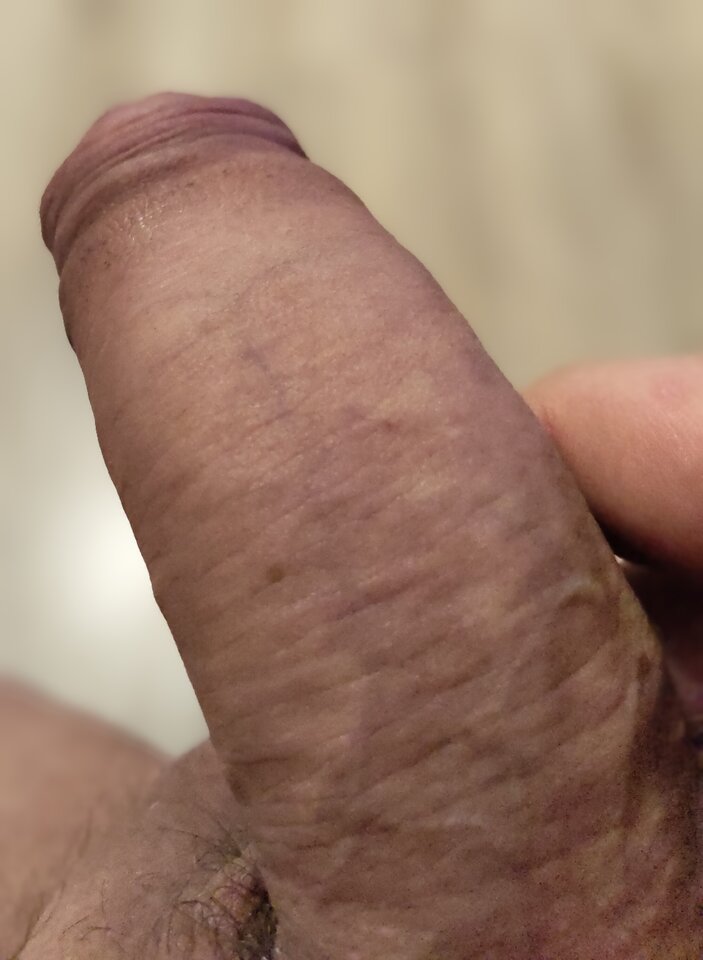 1000014519.jpg - Bi20cm1