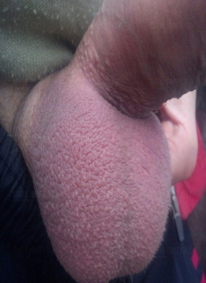 2 jajeczka.JPG - mmojduzy102