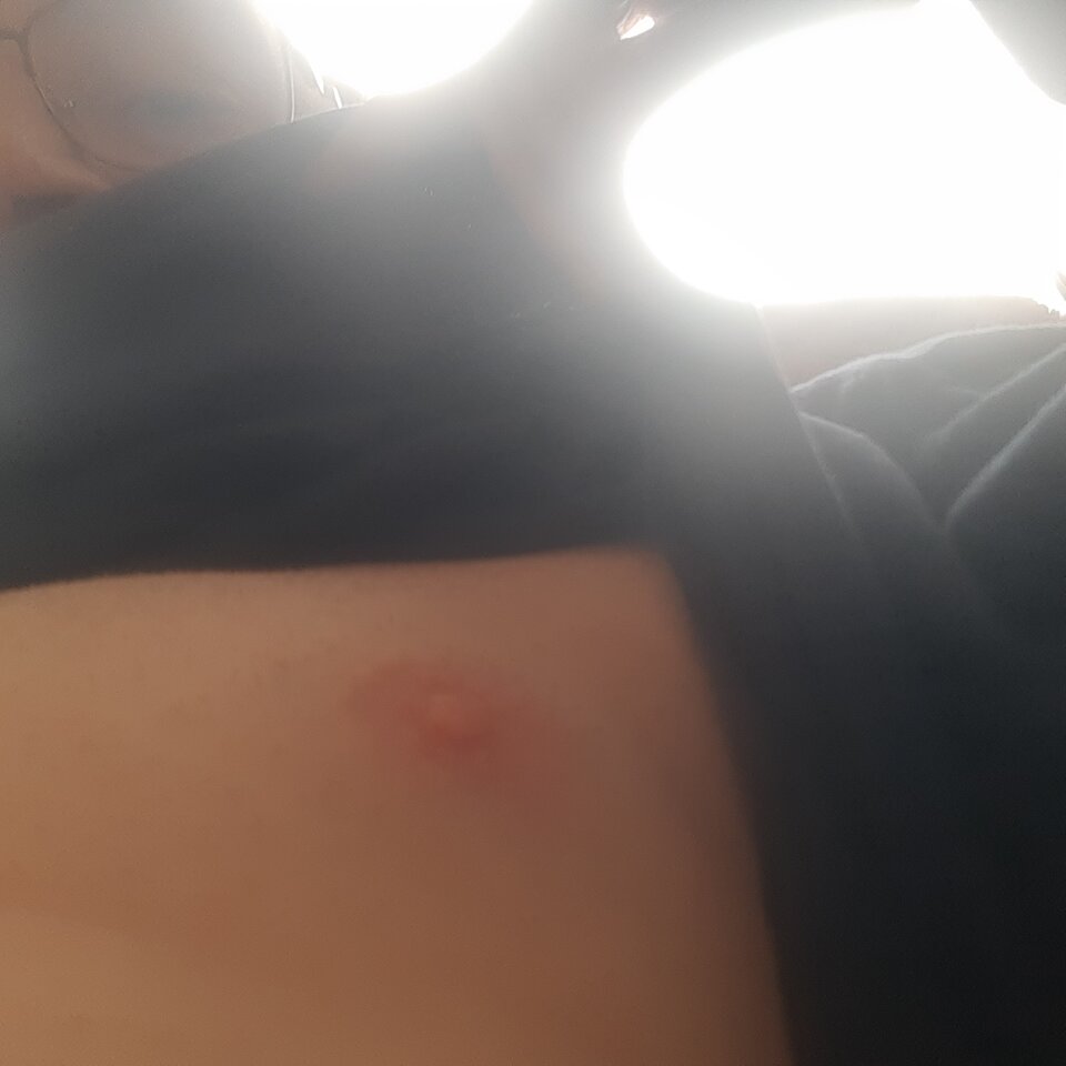 17380623128889138506295879970107.jpg - Palciusia