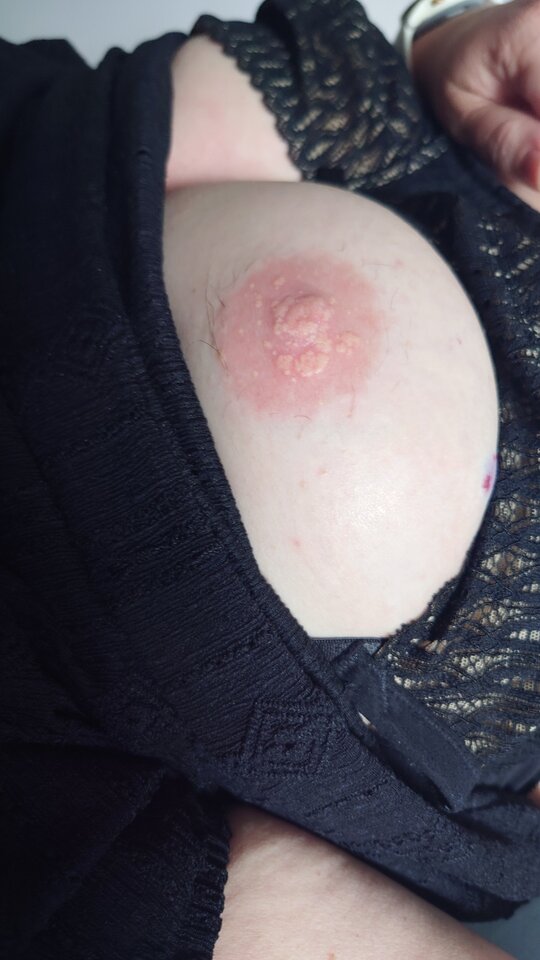 1000007972.jpg - para_KiM