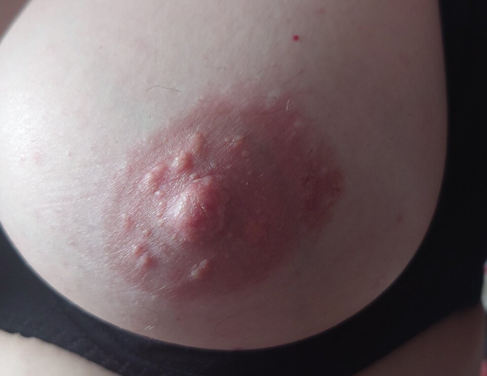 1000007993.jpg - para_KiM