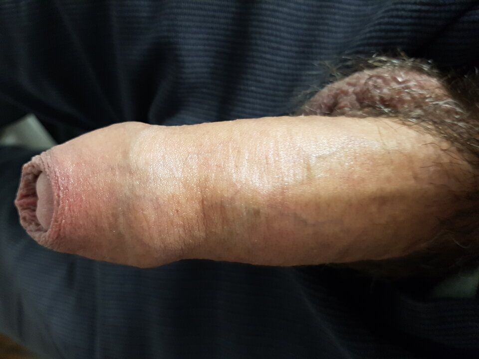 20250212_204505.jpg - Whitelittlecock