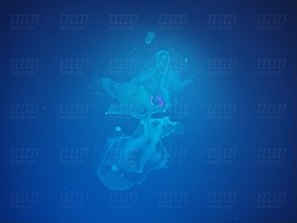 Spermicasso... - zzzzz7