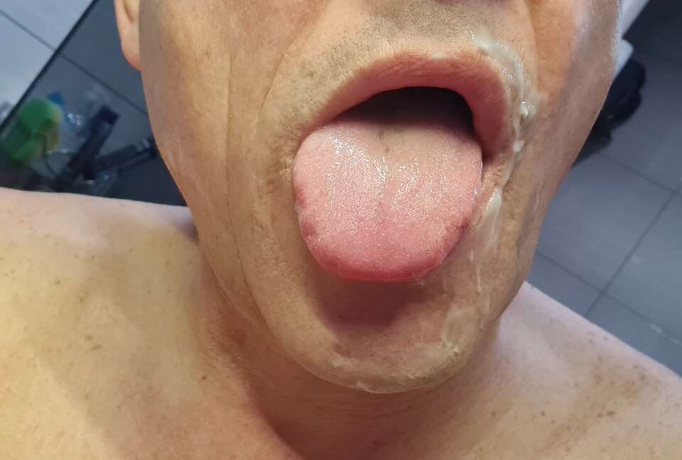 20250228_075936.jpg - On_Lubi_Oral_MM