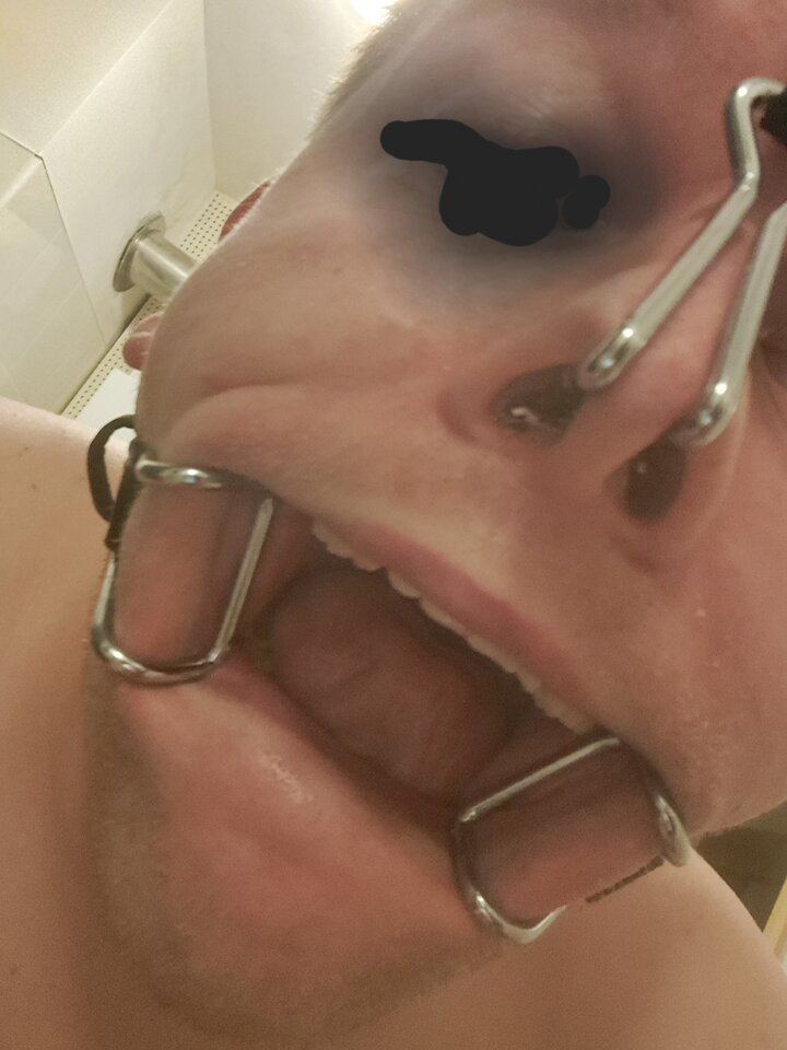 1000009687.jpg - Fetli