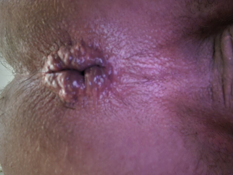 1000003723.jpg - Naturysta70