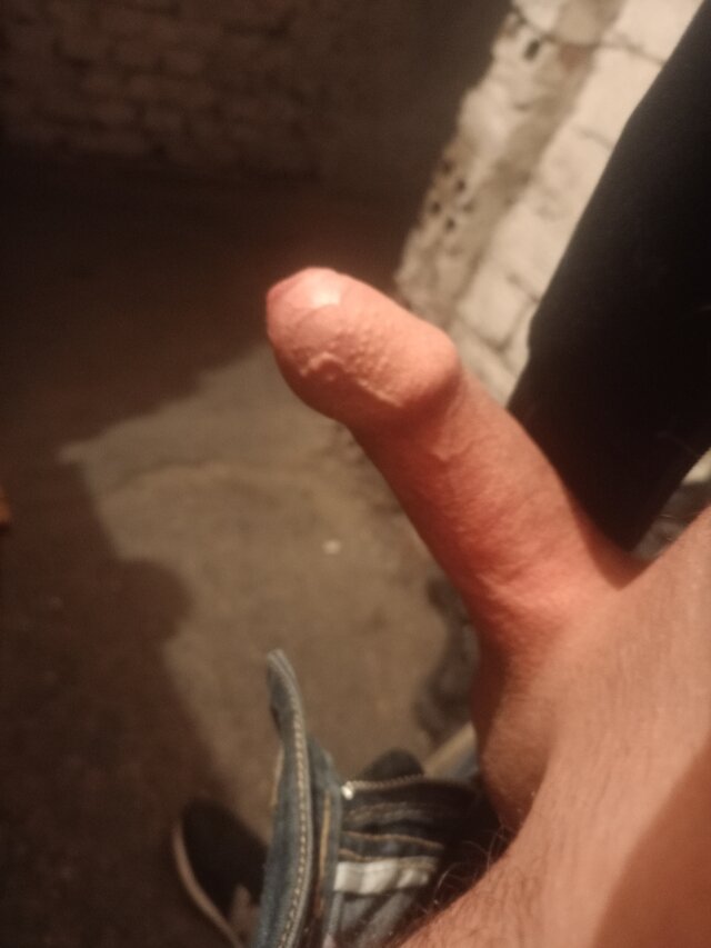 Mati16217564