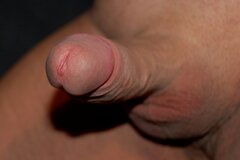 penis z bliska.jpg