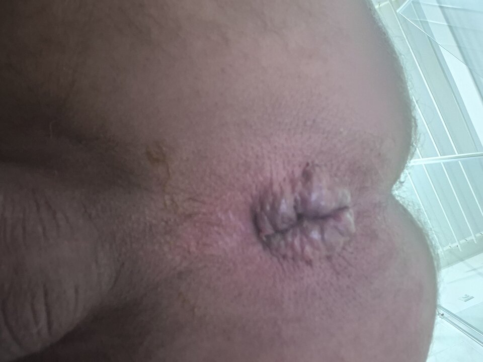 1000003940.jpg - Naturysta70