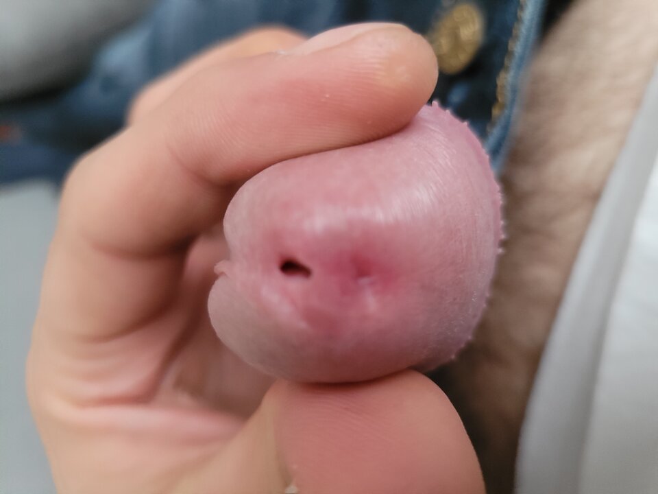 20250325_105332.jpg - collar84