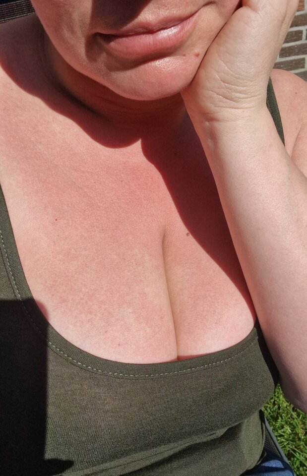 Słoneczko ☺️ - Miszcz_i_Malgorzata