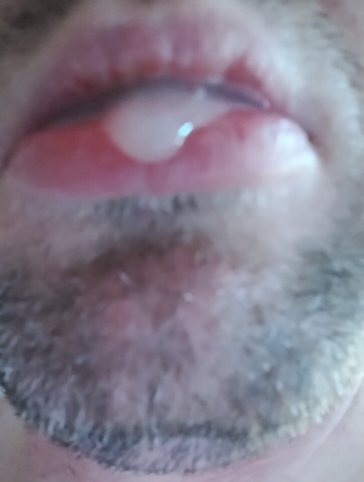 IMG_20250403_180138219~2.jpg - dawcarozkoszy84sprawdzto