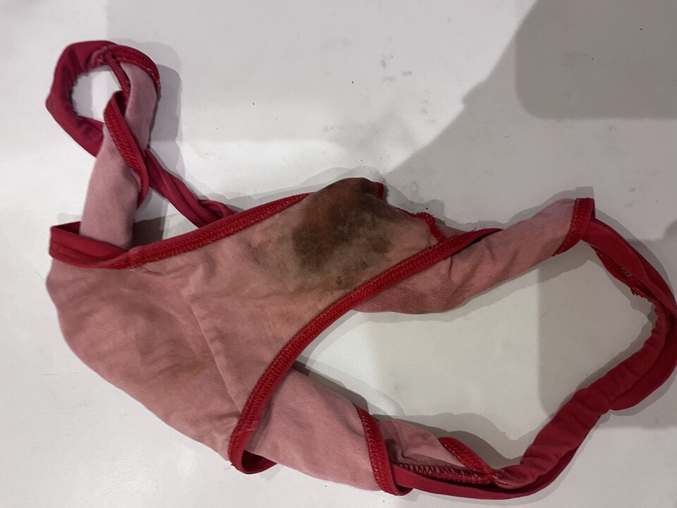 Bolalo - Cipka_na_monety