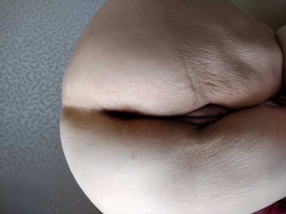 IMG_20230514_090207328.jpeg - Malzentwo