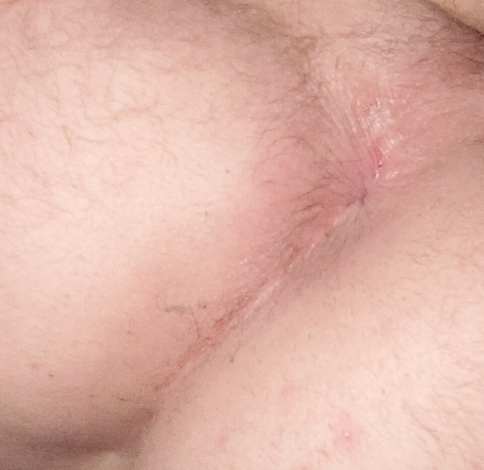 1000010999.jpg - Lisek12445