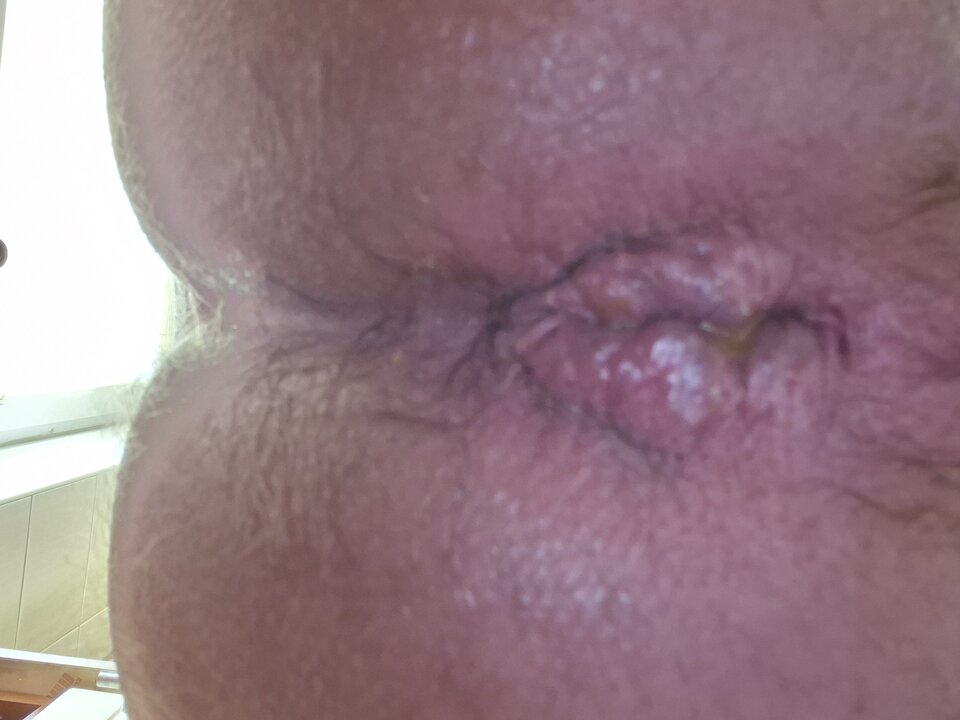 1000005428.jpg - Naturysta70