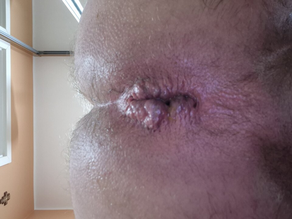 1000005430.jpg - Naturysta70