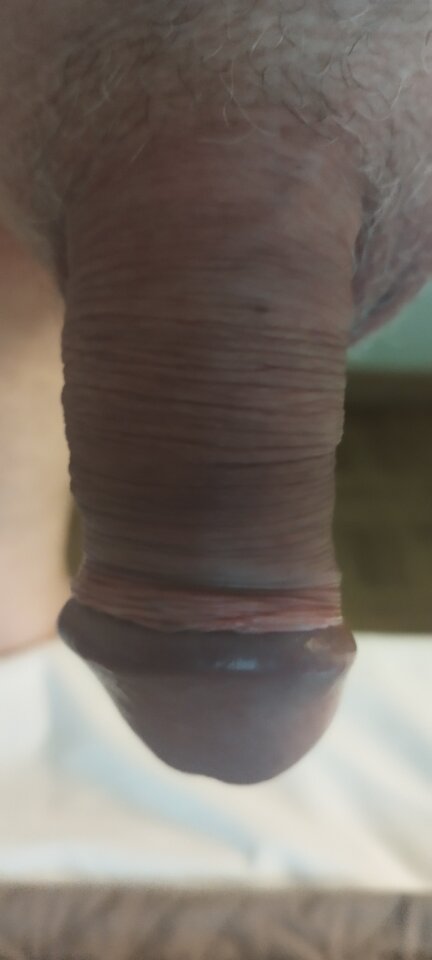 IMG_20250504_100700.jpg - Pio20980