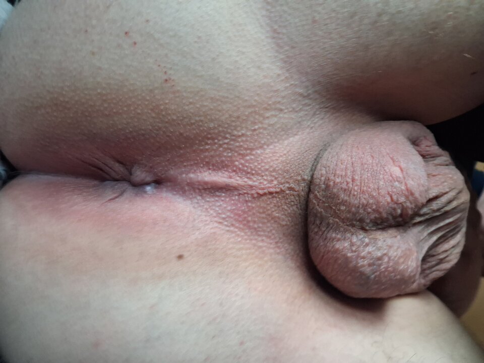1000000807.jpg - Kipser
