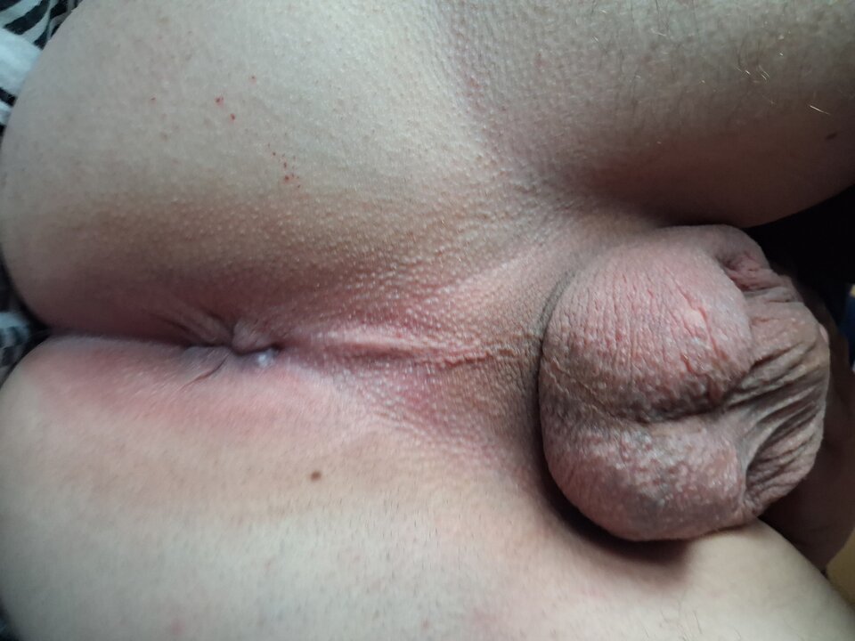 1000000808.jpg - Kipser