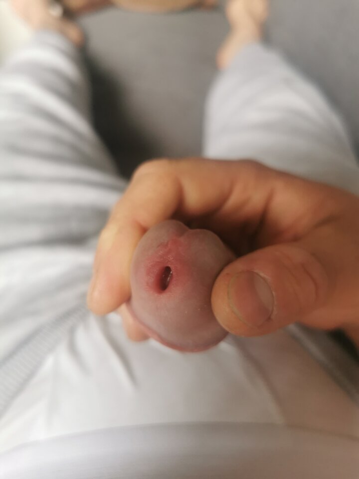 attach.jpeg - siemon