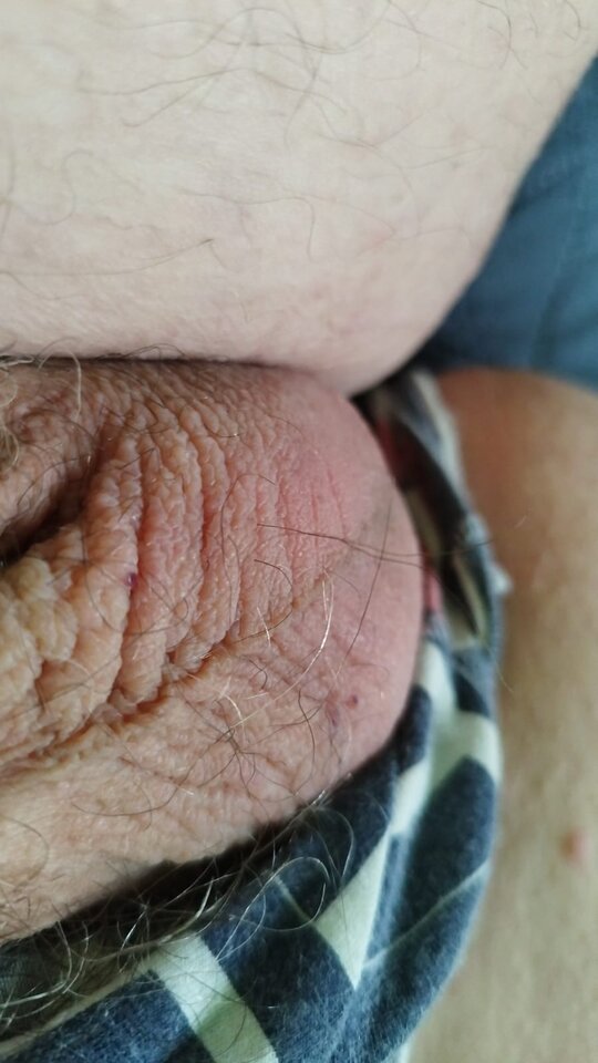 1000094717.jpg - Grubasekpas