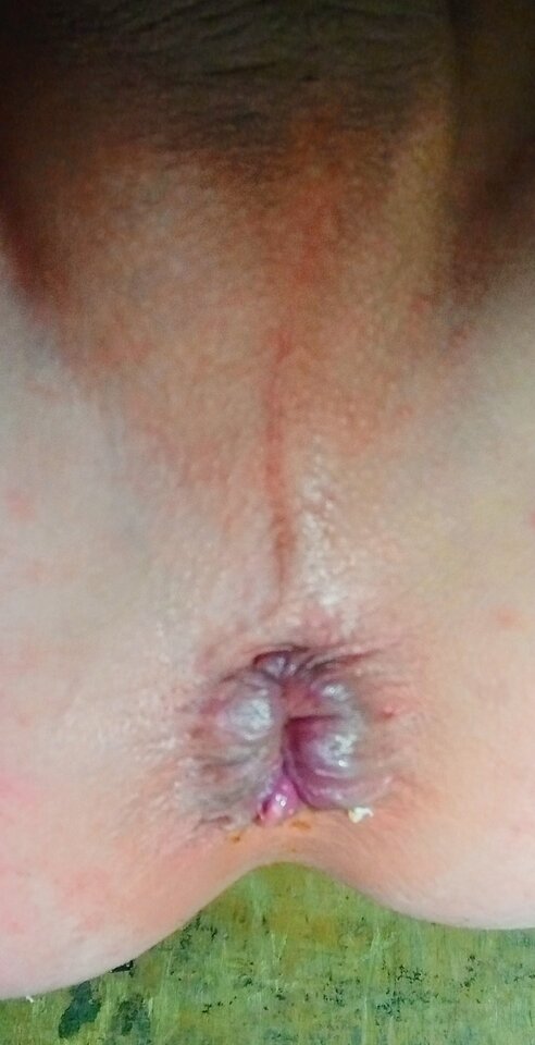 20250608_032504~2.jpg - abac1991