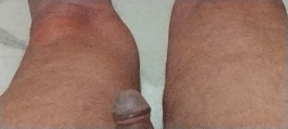 1000007304.jpg - endzik