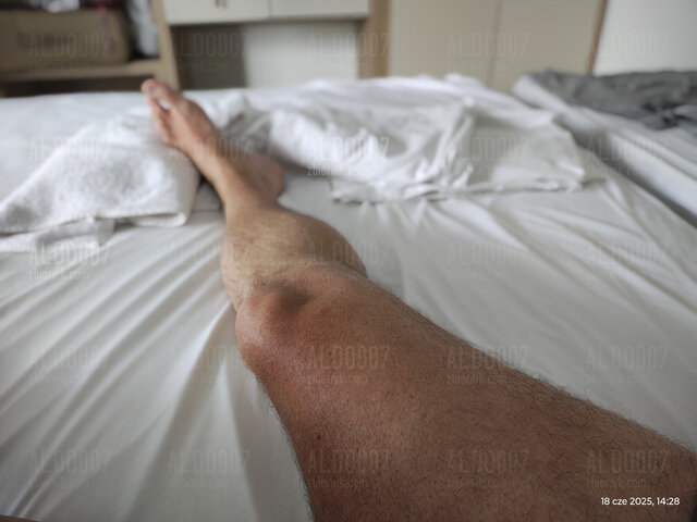 Aldo007