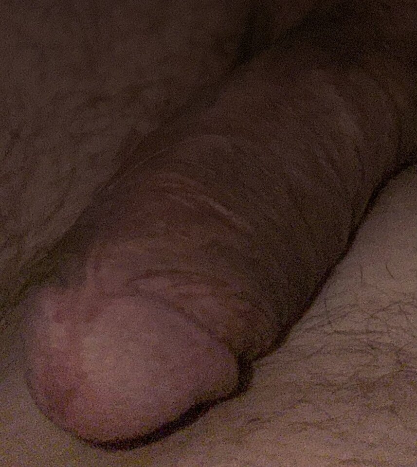 IMG_7918.jpeg - buzzzzz