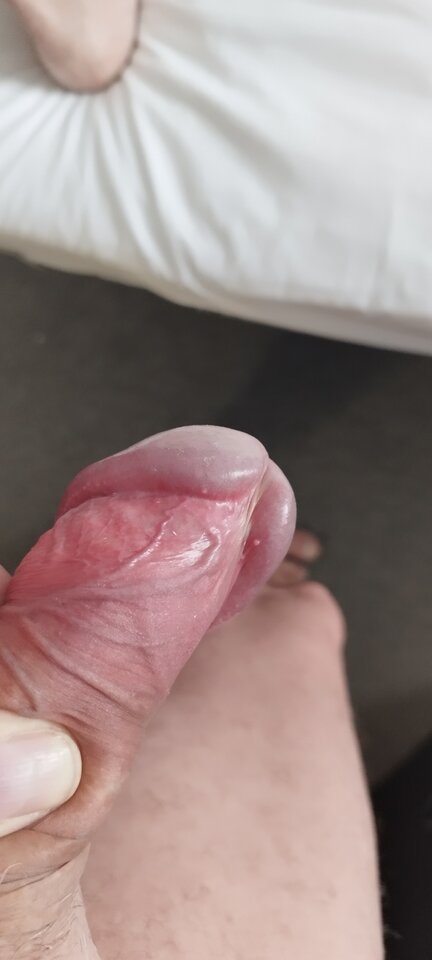 IMG_20250709_125911.jpg - Pio20980