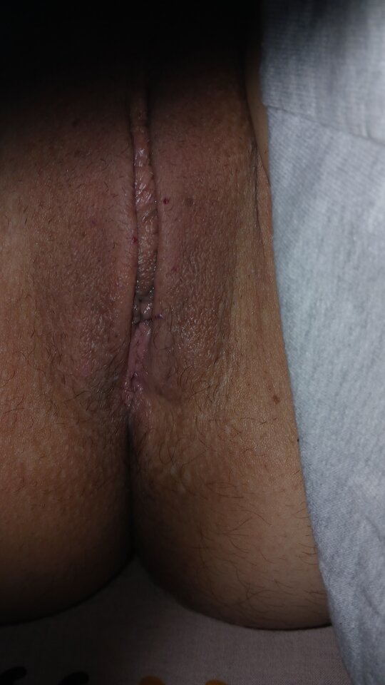 1000005148.jpg - kusy13