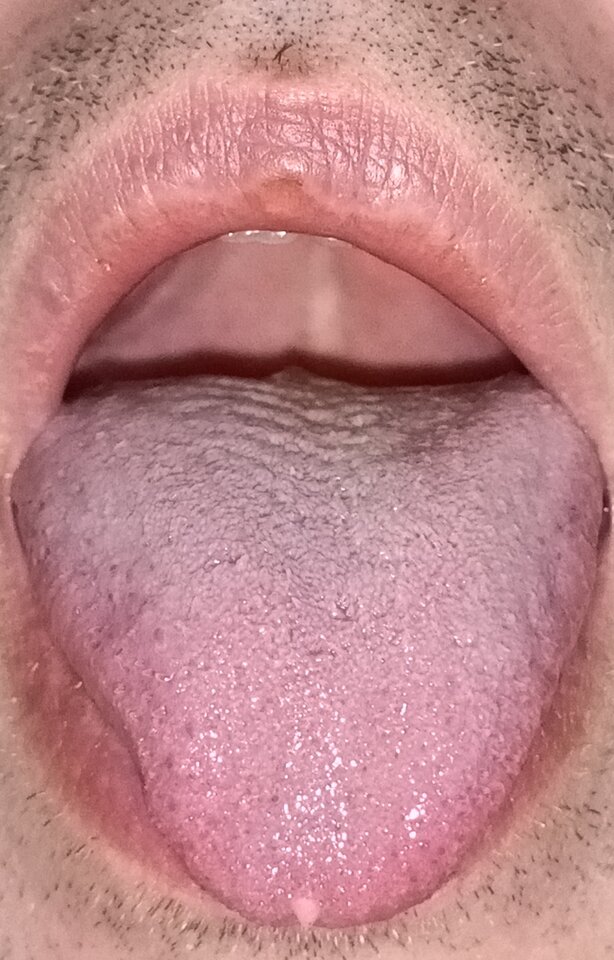 1000004609.jpg - UleglyDoPonizania