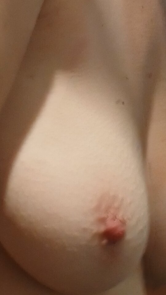 1000005621.jpg - kusy13