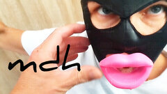 Trochę spuchły od ciągnięcia