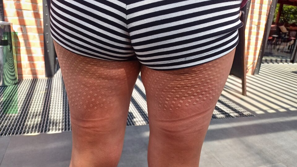 1000018532.jpg - ParaAR8177