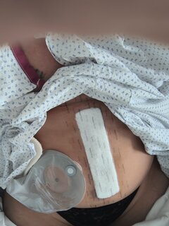 Po operacji kto chce pomóc może dać kr lub bliczka