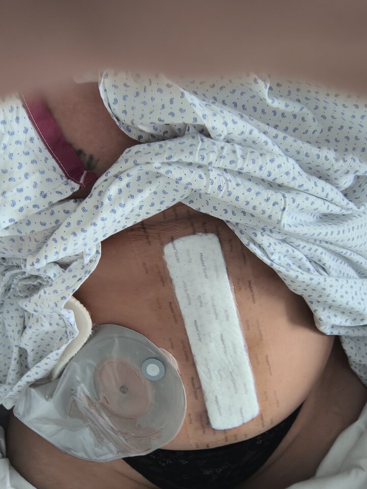 Po operacji kto chce pomóc może dać kr lub bliczka - Diablica41