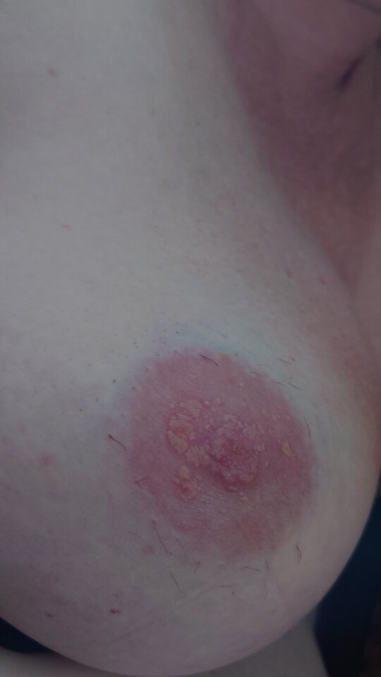 1000011142.jpg - para_KiM