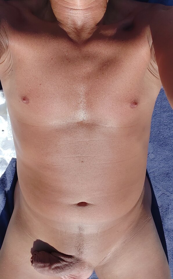 20220817_164041 (1)(1).jpg - Marksmile