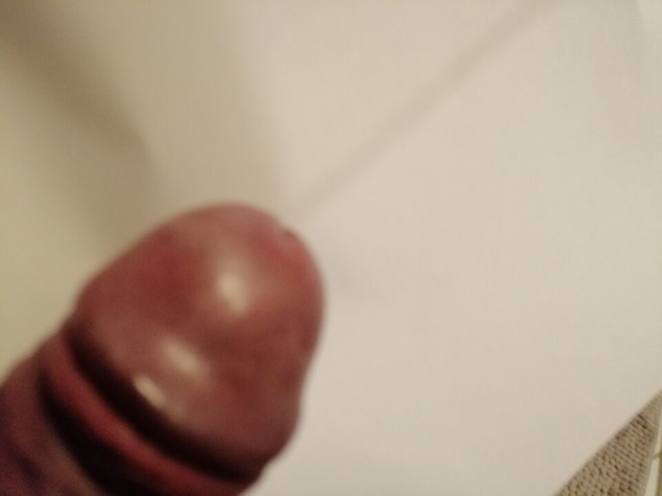 IMG_20250816_045007.jpg - Xyxox