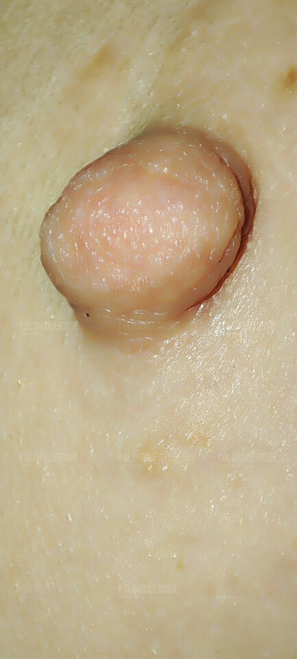 IMG_20250617_234843.jpg - kolorowemisie