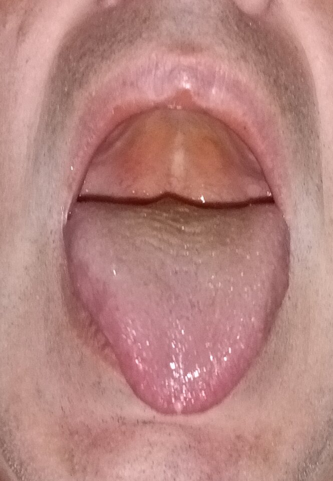 1000005674.jpg - UleglyDoPonizania