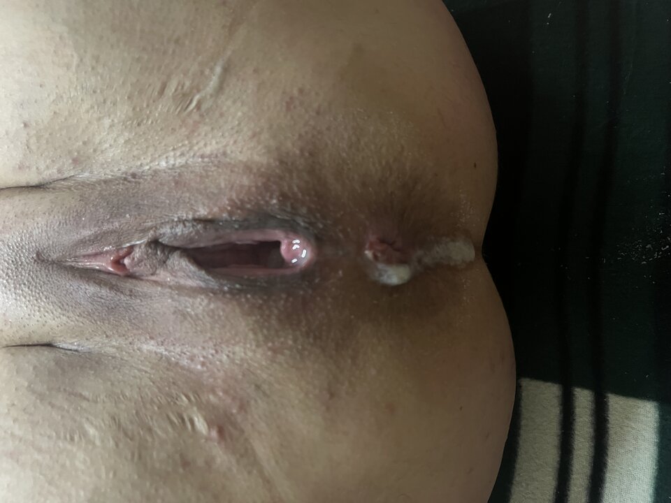 IMG_8084.jpeg - Bart1Ann1