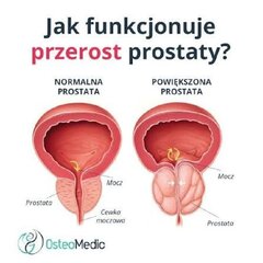 prostata.jpg