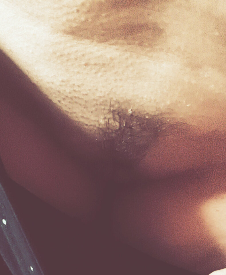 1000015198.jpg - MBSL